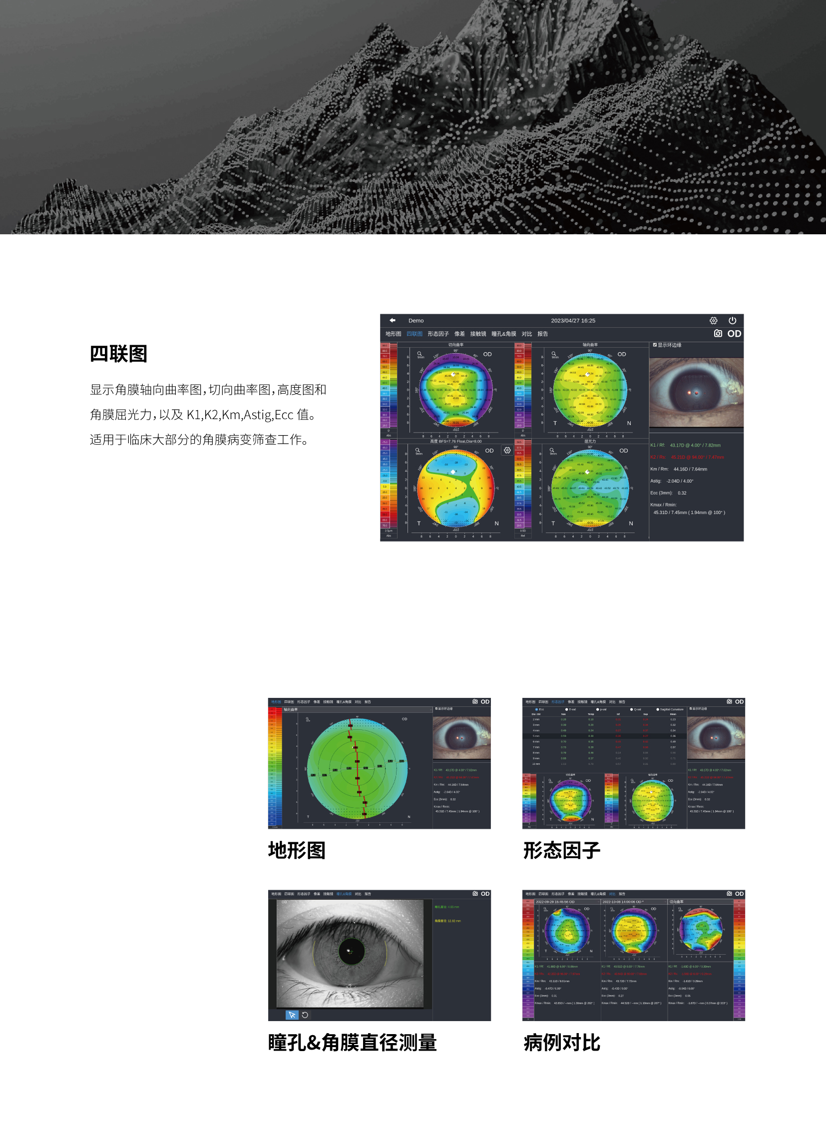 DEA520 干眼和角膜地形图测试仪 20230829-07.jpg