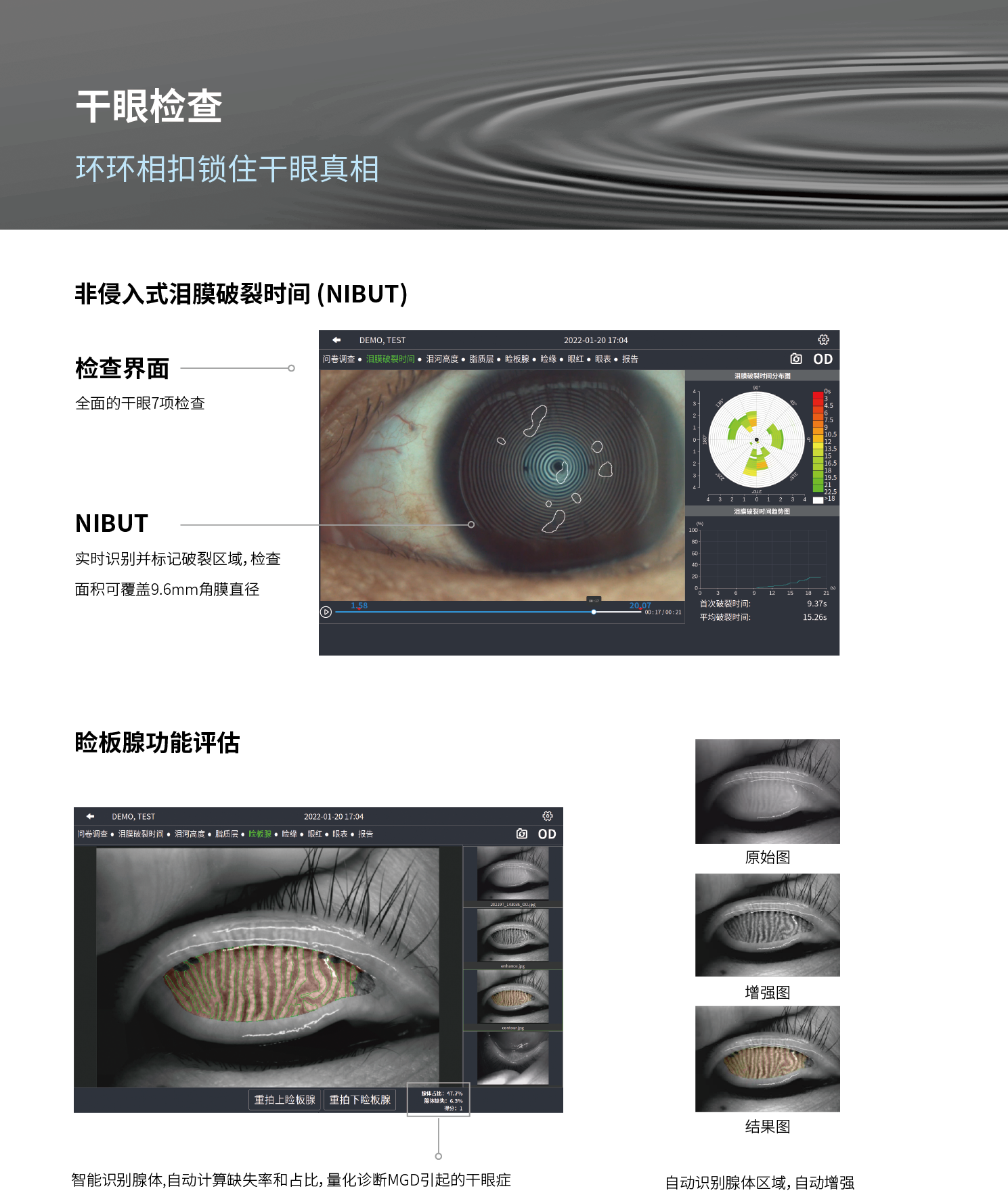 DEA 520干眼和角膜地形图测试仪 20220919aa-04.png