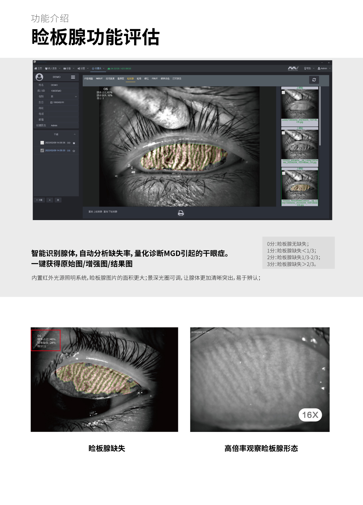 S390L+D130 一站式眼表综合检查平台 20230830 - 副本-08.jpg