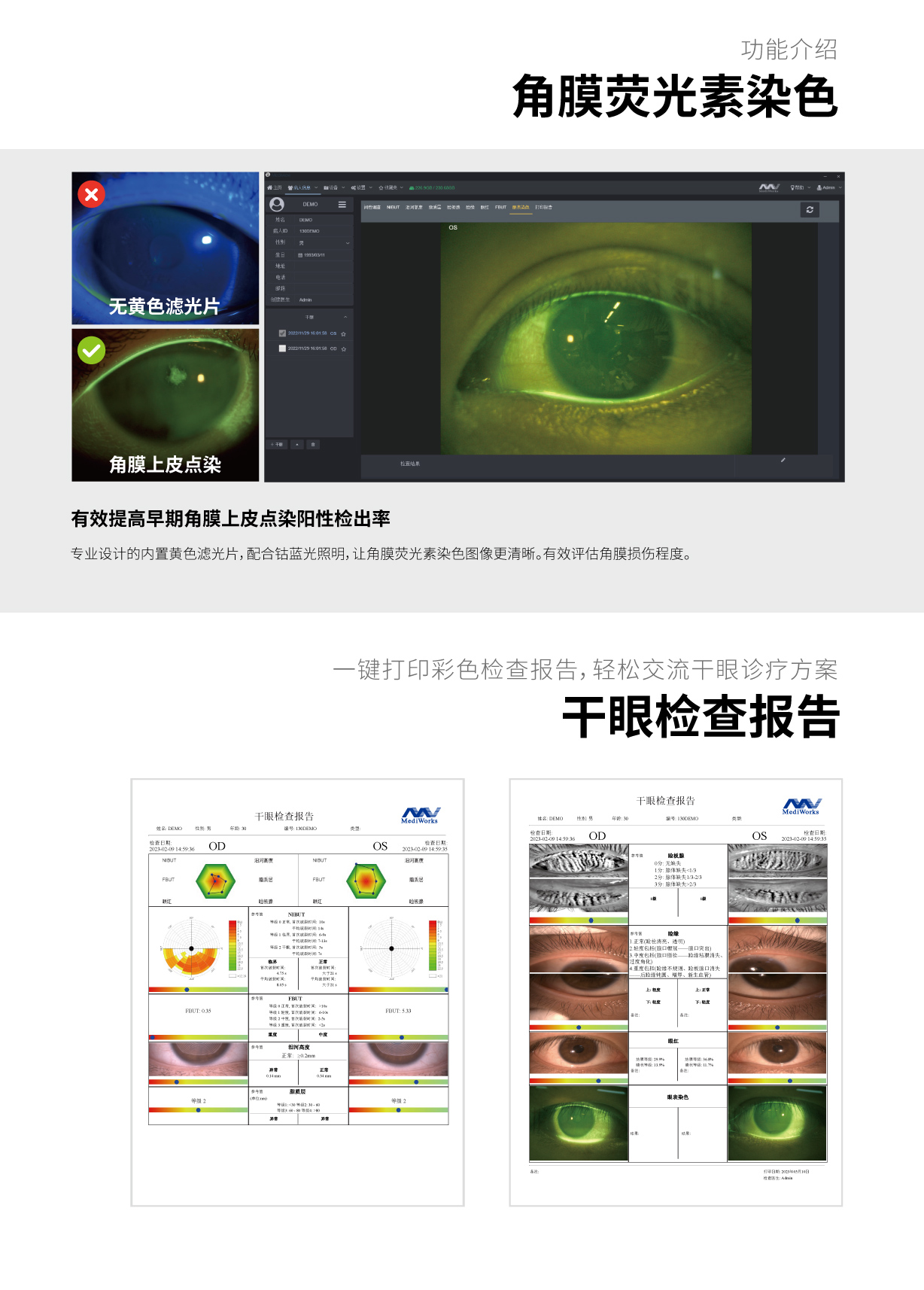 S390L+D130 一站式眼表综合检查平台 20230830 - 副本-11.jpg