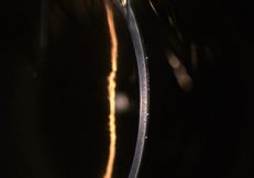 高灵敏度